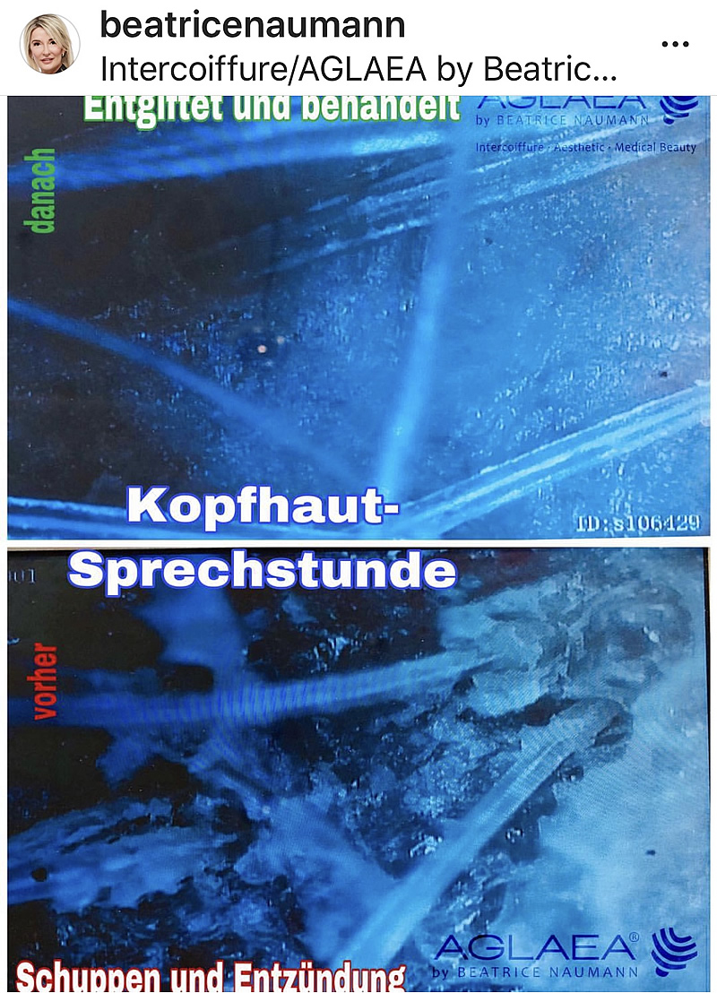 Kopfhaut-Sprechstunde